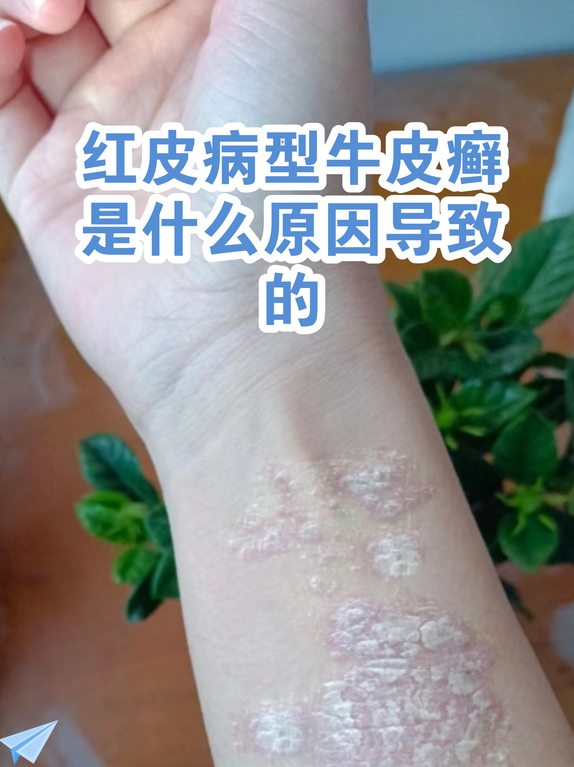 “最新病毒感染2019” 最新病毒感染什么症状？-第3张图片