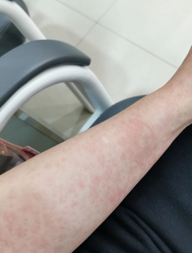 “最新病毒感染2019” 最新病毒感染什么症状？-第2张图片