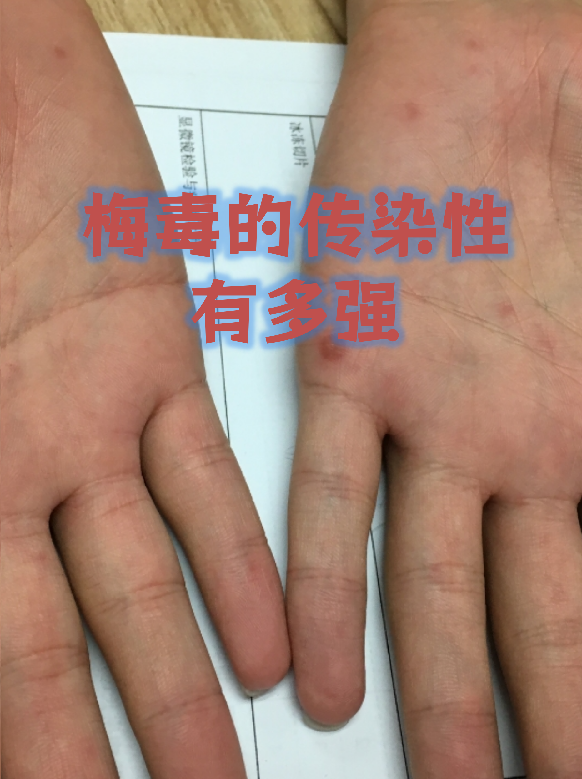 “北京本起疫情初判传播风险高	” 北京疫情现超级传播？-第3张图片