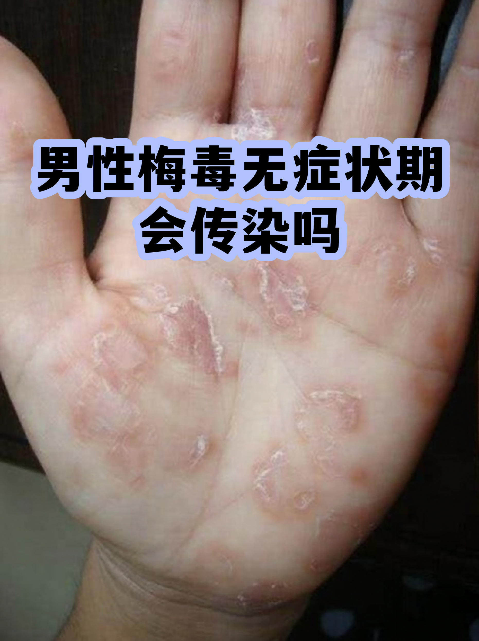 “四川无症状感染者	” 四川 无症状？-第2张图片